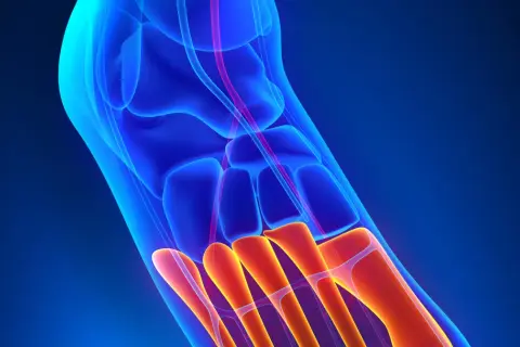 Anatomia stopy: widok 3D kości stępu i śródstopia w kolorach niebieskim i pomarańczowym.